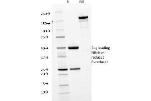 SDS-PAGE Analysis Purified IgM Mouse Monoclonal Antibody (IGHM/1623). (IGHM antibody)