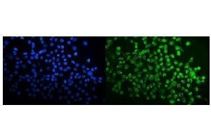 IF analysis of SPAK/STK39 using anti-SPAK/STK39 antibody (ABIN7601373). (STK39 antibody  (AA 338-545))