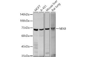 Western blot analysis of extracts of various cell lines, using NEK8 antibody (ABIN3021225, ABIN3021226, ABIN3021227 and ABIN6214075) at 1:500 dilution.