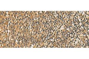 Immunohistochemistry of paraffin-embedded Human tonsil tissue using FAAP100 Polyclonal Antibody at dilution of 1:50(x200) (C17orf70 antibody)