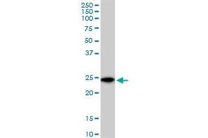VBP1 MaxPab polyclonal antibody. (VBP1 antibody  (AA 1-197))