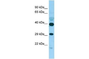 WB Suggested Anti-PISD Antibody Titration: 1. (PISD antibody  (C-Term))