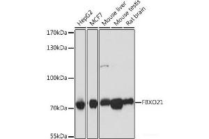 Western blot analysis of extracts of various cell lines using FBXO21 Polyclonal Antibody at dilution of 1:1000. (FBXO21 antibody)