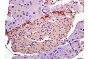 anti-Pleckstrin Homology-Like Domain, Family A, Member 1 (PHLDA1) (AA 251-360) antibody