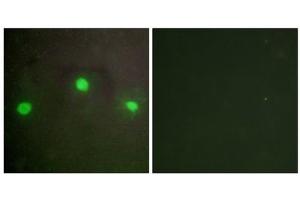 Immunofluorescence analysis of A549 cells, using ATRX antibody.