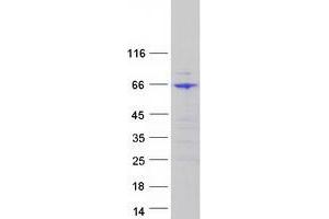 Validation with Western Blot
