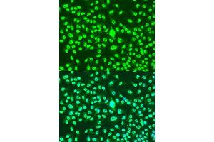 Immunofluorescence analysis of U2OS cells using CCNA2 antibody. (Cyclin A antibody)