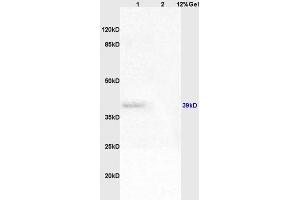 Lane 1: rat brain lysates Lane 2: rat liver lysates probed with Anti Adenovirus 5 E1A Polyclonal Antibody, Unconjugated (ABIN762941) at 1:200 in 4 °C. (Human Adenovirus type 5 E1A (HAdV-5 E1A) (AA 181-280) antibody)