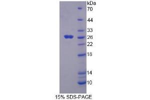 SDS-PAGE analysis of Mouse FADD Protein.