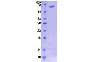 SDS-PAGE (SDS) image for Microtubule-Associated Protein 4 (MAP4) (AA 243-549) protein (His tag,GST tag) (ABIN4988665) (MAP4 Protein (AA 243-549) (His tag,GST tag))