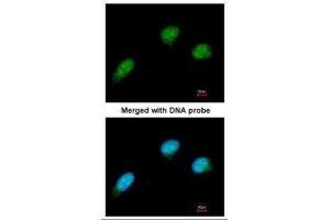 ICC/IF Image Immunofluorescence analysis of paraformaldehyde-fixed HeLa, using CTBP2, antibody at 1:100 dilution. (CTBP2 antibody  (C-Term))