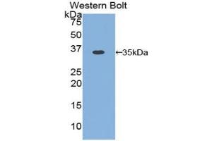 Western blot analysis of the recombinant protein. (Cyclin D1 antibody  (AA 1-292))