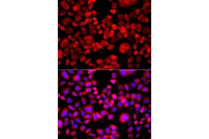 Immunofluorescence analysis of A549 cell using EIF4G1 antibody.