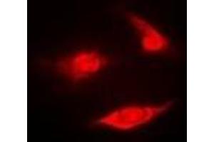 Immunofluorescent analysis of PSMB2 staining in U2OS cells.