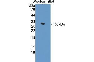 Detection of Recombinant IkBd, Mouse using Polyclonal Antibody to Inhibitory Subunit Of NF Kappa B Delta (IkBd) (IkBd antibody  (AA 58-304))