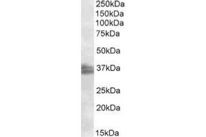 AP20113PU-N FRG1 antibody staining of Jurkat nuclear lysate at 2 µg/ml (RIPA buffer, 35 µg total protein per lane). (FRG1 antibody  (Internal Region))