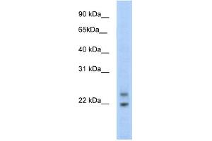 WB Suggested Anti-C330003B14RIK Antibody Titration:  5. (CPHX antibody  (N-Term))