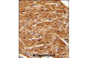FGF7 antibody (Center) (ABIN654152 and ABIN2844021) immunohistochemistry analysis in formalin fixed and paraffin embedded human M. (FGF7 antibody  (AA 57-86))