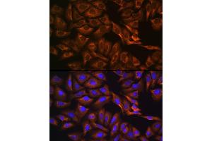 Immunofluorescence analysis of U-2 OS cells using C Rabbit pAb (ABIN6129248, ABIN6137933, ABIN6137934 and ABIN6223903) at dilution of 1:100 (40x lens). (Caprin-1 antibody)