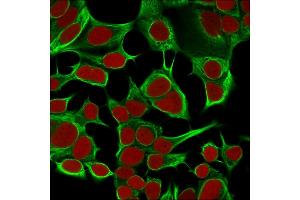 Immunofluorescence (IF) image for anti-Keratin 18 (KRT18) antibody (ABIN6939932)