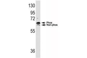 Western Blotting (WB) image for anti-Ribosomal Protein S6 Kinase, 70kDa, Polypeptide 1 (RPS6KB1) (AA 425-454) antibody (ABIN3032481)