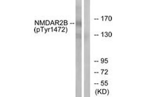 Western blot analysis of extracts from Jurkat cells treated with UV 15', using NMDAR2B (Phospho-Tyr1474) Antibody. (GRIN2B antibody  (pTyr1474))