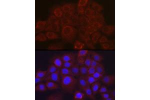 Immunofluorescence analysis of  cells using SSC/SerpinB3 Rabbit pAb (ABIN6131348, ABIN6147587, ABIN6147588 and ABIN6221070) at dilution of 1:100 (40x lens). (SERPINB3 antibody  (AA 1-230))