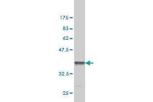 Western Blot detection against Immunogen (36. (DGKH antibody  (AA 831-930))
