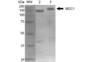 Western Blot analysis of Mouse Cortex and Cerebellum showing detection of 184 kDa MDC1 protein using Mouse Anti-MDC1 Monoclonal Antibody, Clone P2B11 . (MDC1 antibody  (N-Term) (Biotin))