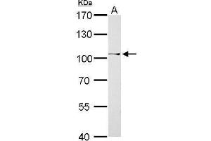 WB Image CtBP2 antibody detects CTBP2 protein by Western blot analysis. (CTBP2 antibody  (C-Term))