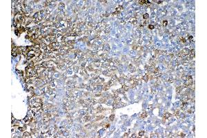 Immunohistochemistry (IHC) image for anti-Insulin-Like Growth Factor Binding Protein 1 (IGFBPI) (AA 26-272) antibody (ABIN5519002)