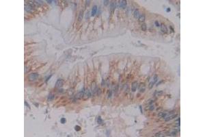 Used in DAB staining on fromalin fixed paraffin- embedded Kidney tissue (MUC3B antibody  (AA 836-931))