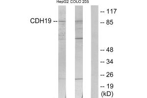 Western blot analysis of extracts from HepG2 cells and COLO205 cells, using CDH19 antibody.