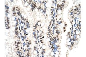 RUNDC2A antibody was used for immunohistochemistry at a concentration of 4-8 ug/ml to stain Epithelial cells of intestinal villus (arrows) in Human Intestine.