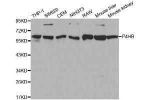 Western Blotting (WB) image for anti-Prolyl 4-Hydroxylase, beta Polypeptide (P4HB) (AA 329-508) antibody (ABIN3021094)