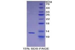 SDS-PAGE (SDS) image for Chemokine (C-X-C Motif) Ligand 14 (CXCL14) (AA 23-99) protein (His tag) (ABIN1879852)