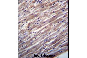 RASD1 Antibody (C-term) (ABIN657026 and ABIN2846202) immunohistochemistry analysis in formalin fixed and paraffin embedded human heart tissue followed by peroxidase conjugation of the secondary antibody and DAB staining.