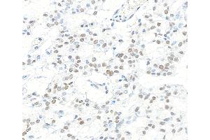 Immunohistochemistry (IHC) image for anti-Cleavage and Polyadenylation Specific Factor 1, 160kDa (CPSF1) (AA 1392-1442) antibody (ABIN7453881) (CPSF1 antibody  (AA 1392-1442))