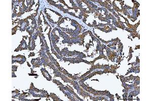 IHC analysis of TRMT61B using anti-TRMT61B antibody (ABIN7602334). (TRMT61B antibody  (AA 7-477))