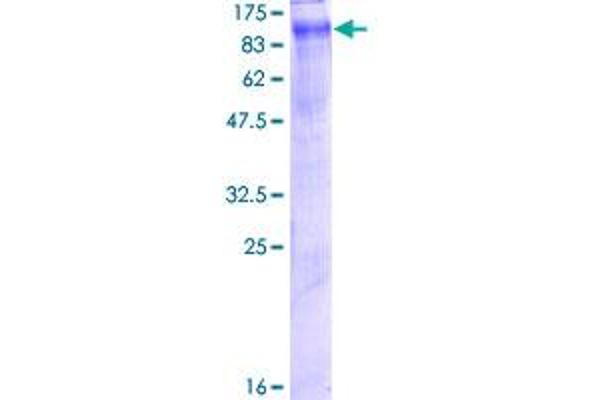 Chloride Channel 5 Protein (CLCN5) (AA 1-746) (GST tag)