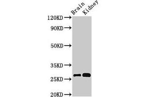 Western Blot Positive WB detected in: Mouse brain tissue, Mouse kidney tissue All lanes: OLFML2B antibody at 3 μg/mL Secondary Goat polyclonal to rabbit IgG at 1/50000 dilution Predicted band size: 84, 28 kDa Observed band size: 28 kDa