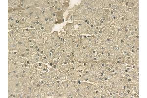 ABIN6256922 and ABIN6273377 at 1/100 staining human normal liver tissue by IHC-P.