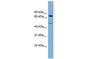 STIM1 antibody used at 1 ug/ml to detect target protein. (STIM1 antibody  (Middle Region))