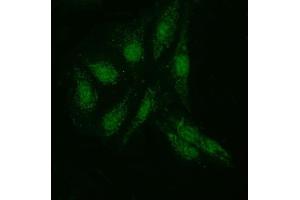 IF analysis of KI/VIRMA using anti-KI/VIRMA antibody (ABIN7599707). (Protein Virilizer Homolog (VIRMA) (AA 11-1529) antibody)
