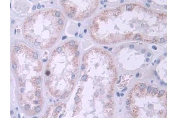 TRPC6 antibody  (AA 1-192)