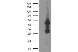 HEK293T cells were transfected with the pCMV6-ENTRY control (Left lane) or pCMV6-ENTRY DOK2 (Right lane) cDNA for 48 hrs and lysed. (DOK2 antibody)