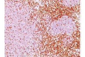 Formalin-fixed, paraffin-embedded human Tonsil (10X) stained with CD6 Monoclonal Antibody (3F7B5). (CD6 antibody)