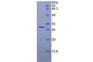 SDS-PAGE analysis of Mouse RIG1 Protein. (DDX58 Protein)