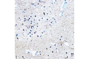 Immunohistochemistry of paraffin-embedded rat brain using Phospho-Tau-S396 Rabbit mAb (ABIN7268523) at dilution of 1:100 (40x lens). (MAPT antibody  (pSer396))
