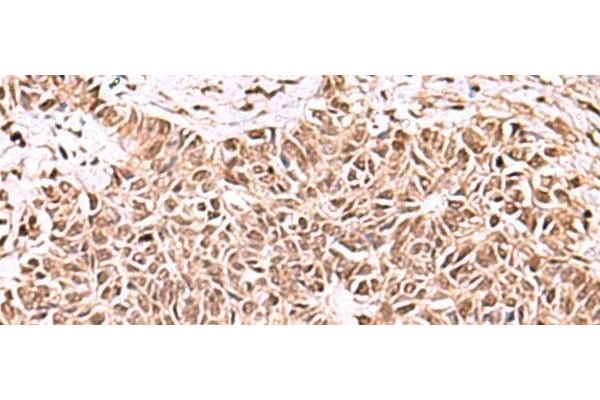 Actin-Like 6B antibody
